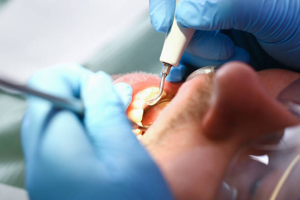 Best Pediatric Emergency Dentist in Lebanon, OR